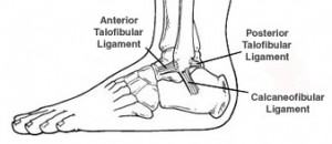 ankle-sprain-doctor-naperville